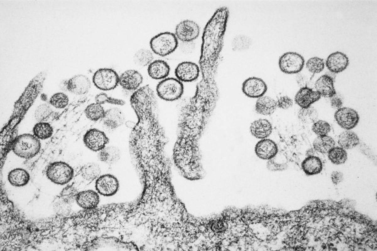 ¡Transmitidos por ratas, monos y aves! Estos son los 10 virus más letales en el mundo