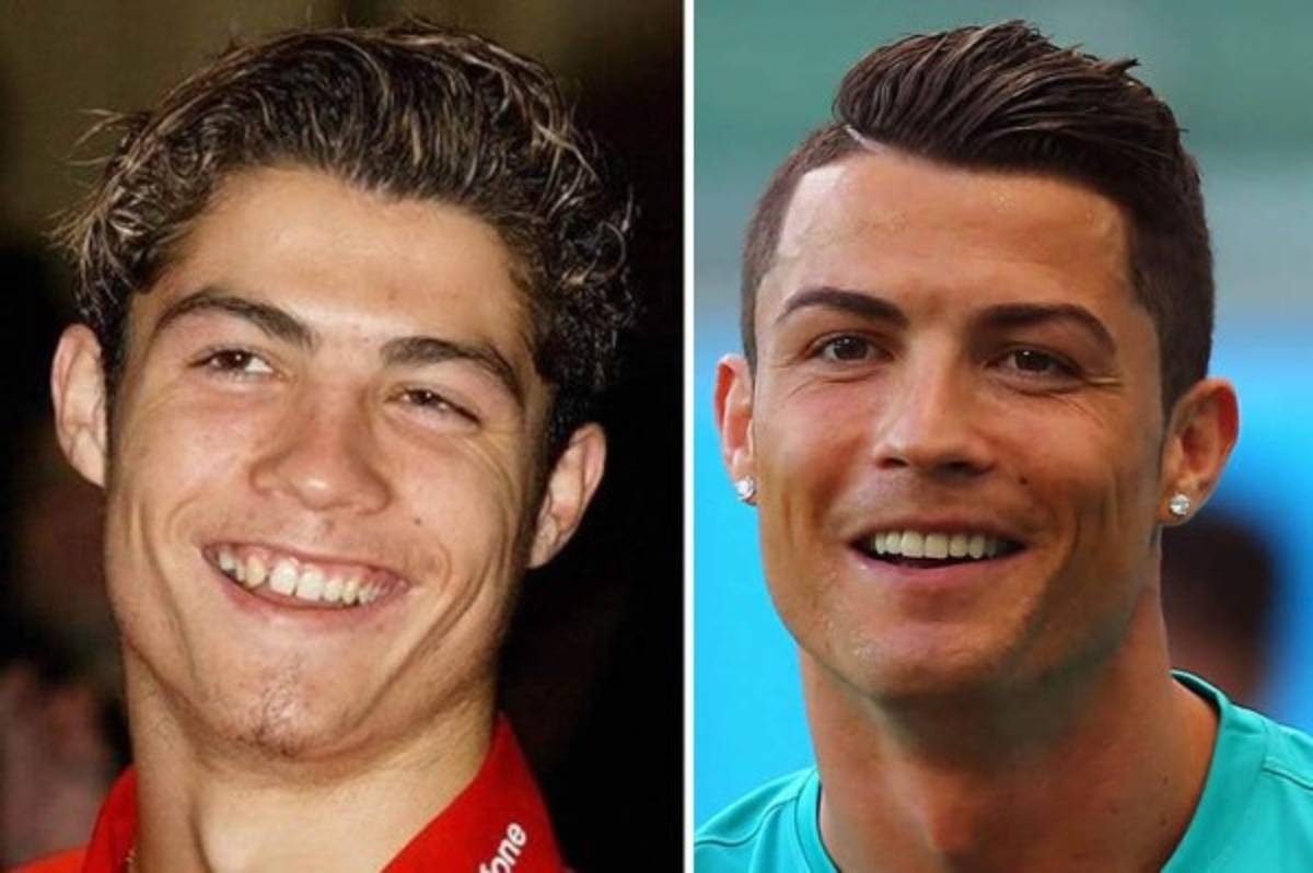 ¡NO ERAN ASÍ! Las figuras que tuvieron que pasar por una cirugía para mejorar su apariencia