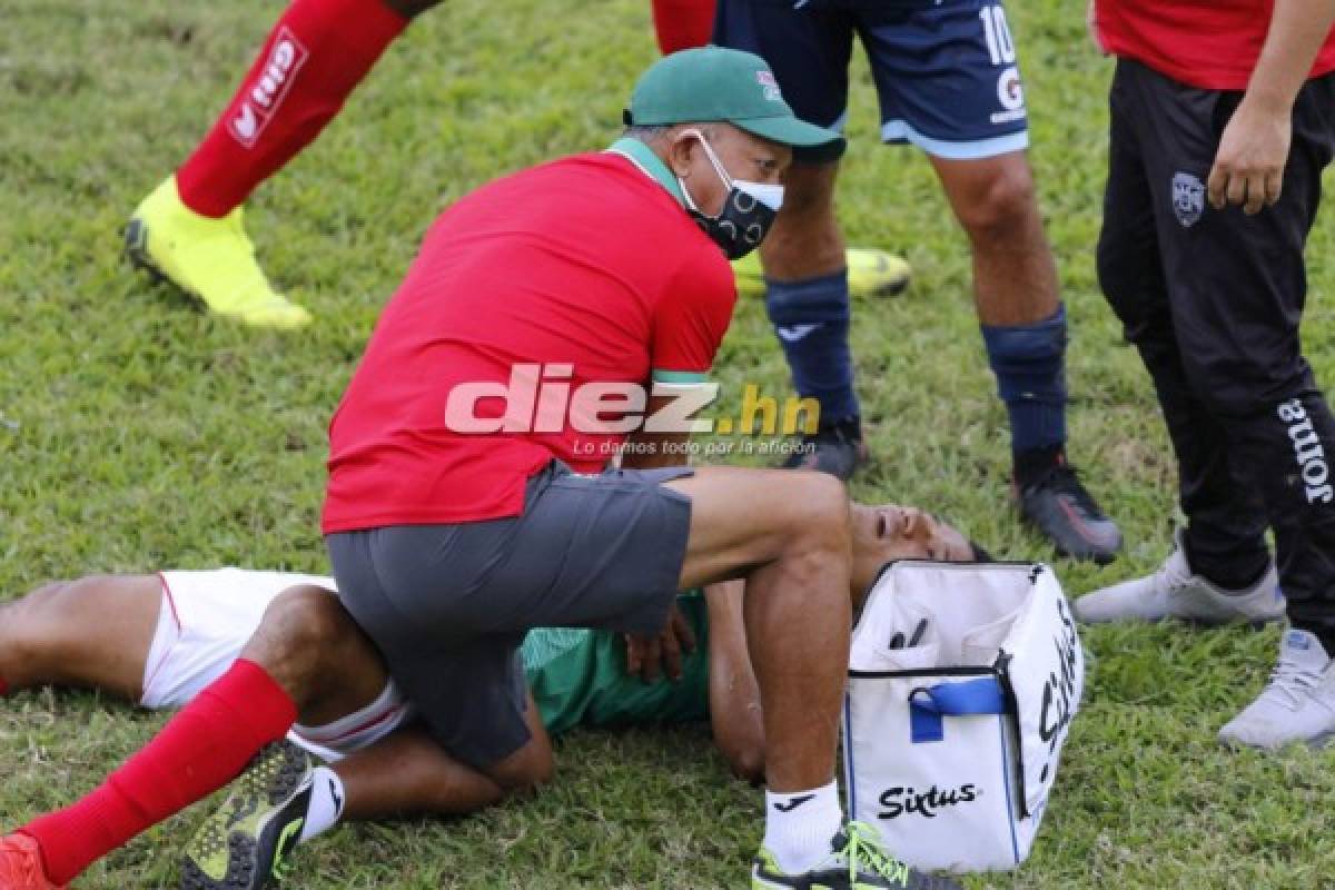 Curiosas: Héctor Vargas expulsado, el rostro de Archivald en gol de Bengtson y visita en el Nacional