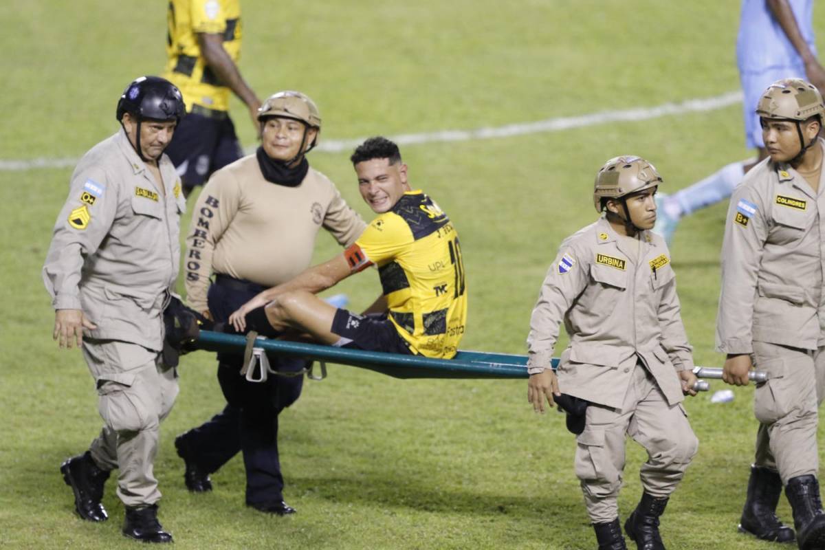 FOTOS: Dos exMotagua sorprenden, Real España sufre duro golpe, error infantil y el enojo que terminó en roja