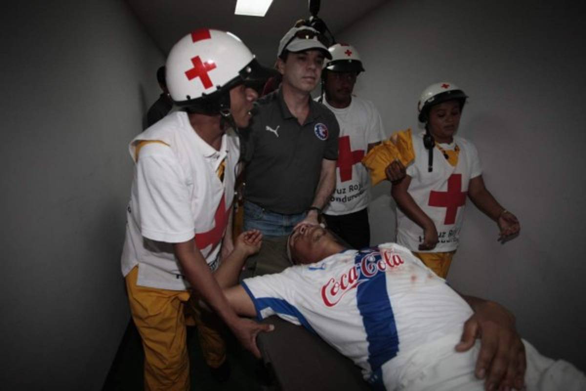 FOTOS: Los golpes y lesiones más brutales del fútbol hondureño
