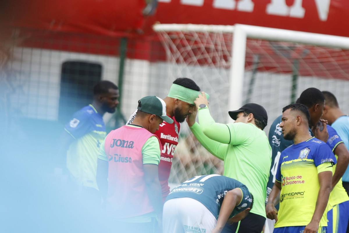 Tremendo diluvio en el Nacional, enfado de los aficionados de Marathón, jugador en muletas, bellas chicas y DT en aprietos