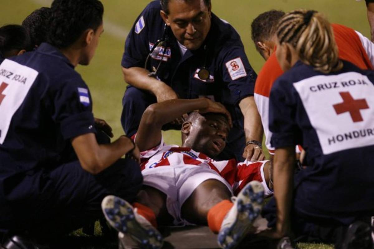 FOTOS: Los golpes y lesiones más brutales del fútbol hondureño