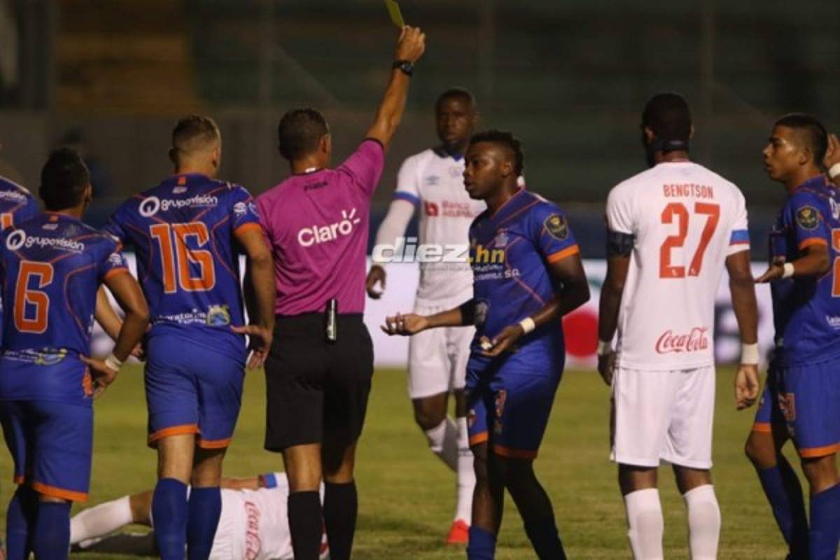 Curiosas: El manotazo de Palermo, Patón Mejía y la reacción de jugadores de UPN tras roja de Axel Gómez