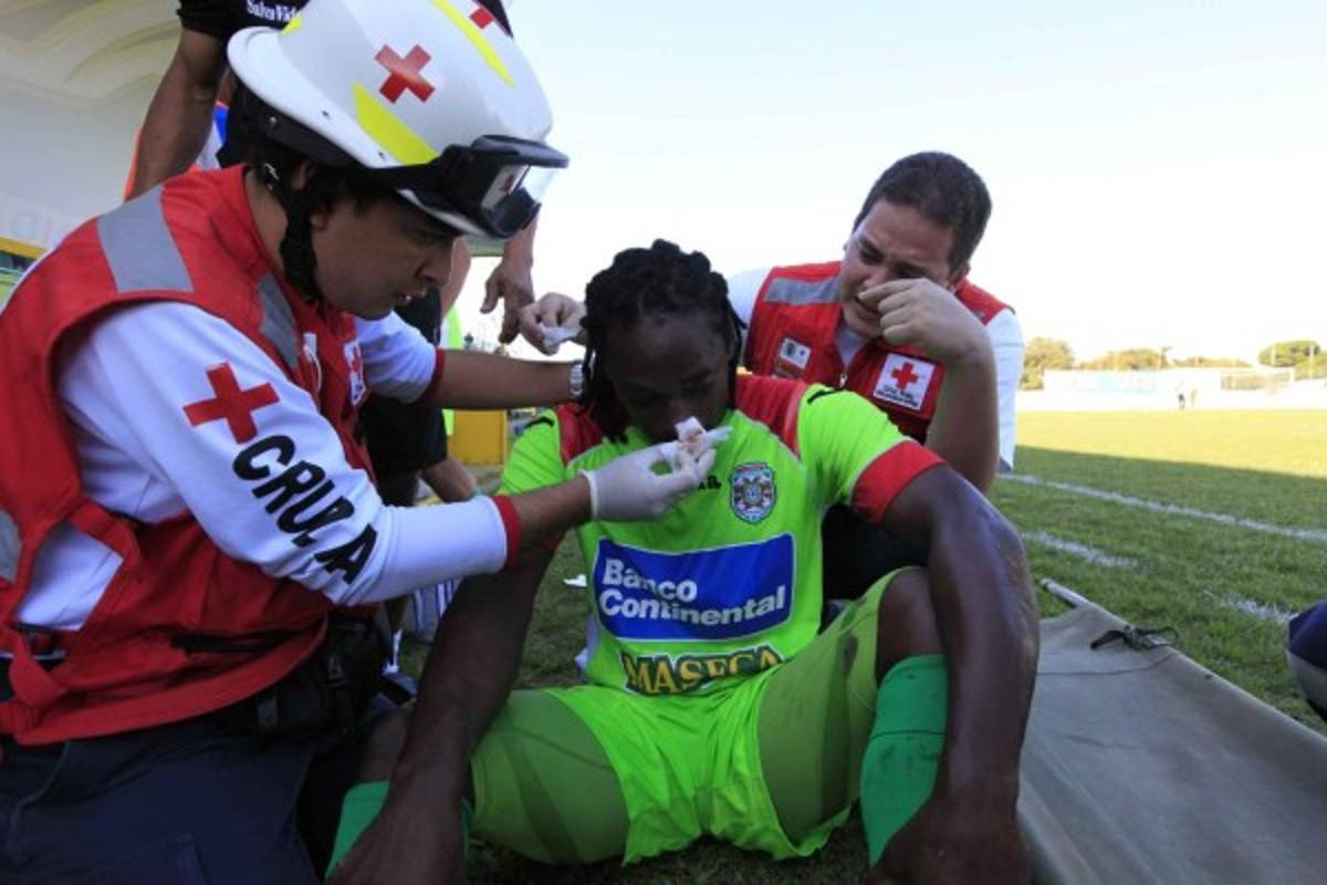 FOTOS: Los golpes y lesiones más brutales del fútbol hondureño