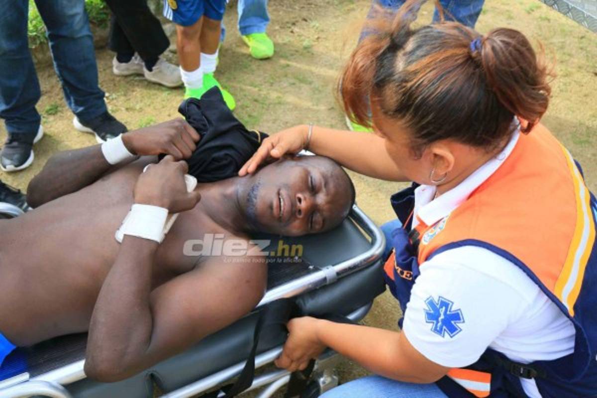 Dramáticas imágenes: El fútbol vuelve a golpear a Rubilio Castillo