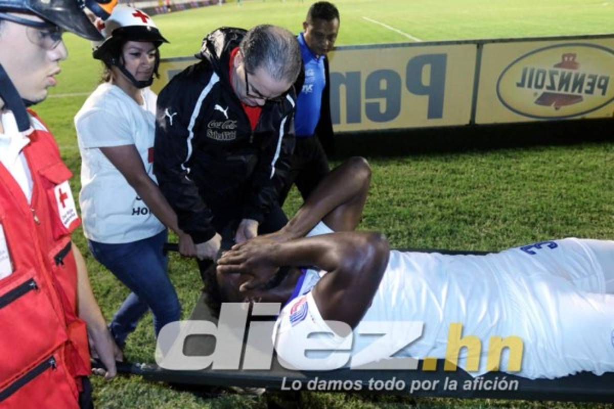 Las imágenes que la televisión no mostró de la jornada 17 en Honduras