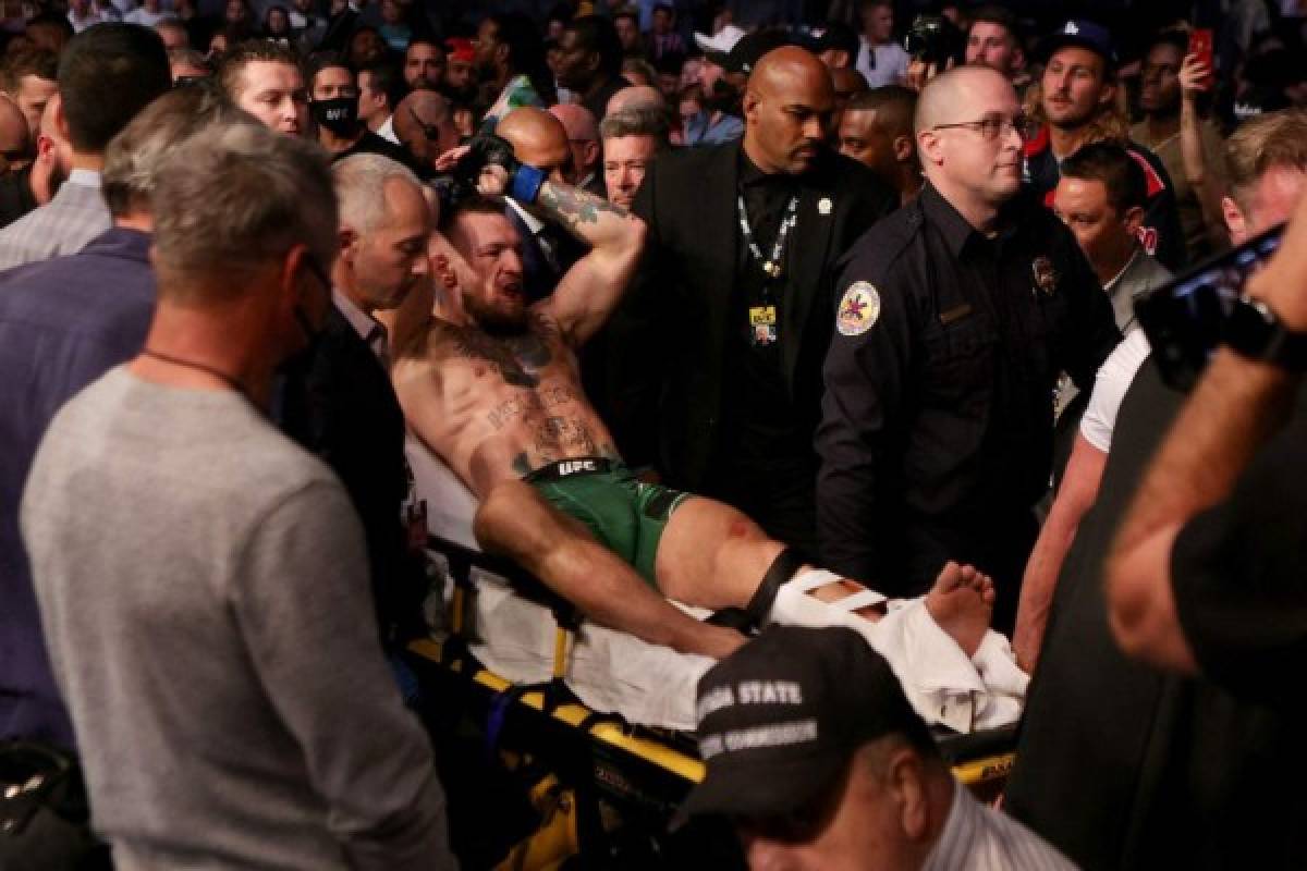 Espeluznantes imágenes: Así quedó la pierna de McGregor tras sufrir una fractura en la UFC