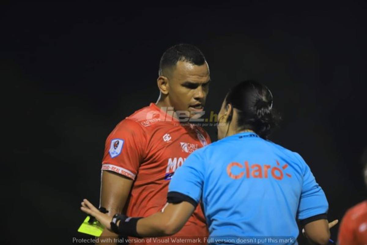 ¡No se vio en TV! El enorme beso de Chavasco; la belleza que eclipsó La Ceiba y la furia de Jorge Cardona