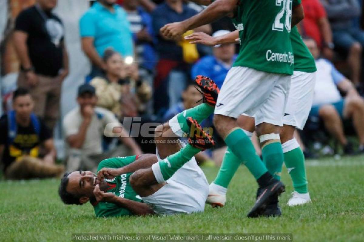 FOTOS: Así lucen los jugadores de Liga Nacional ahora en el retiro