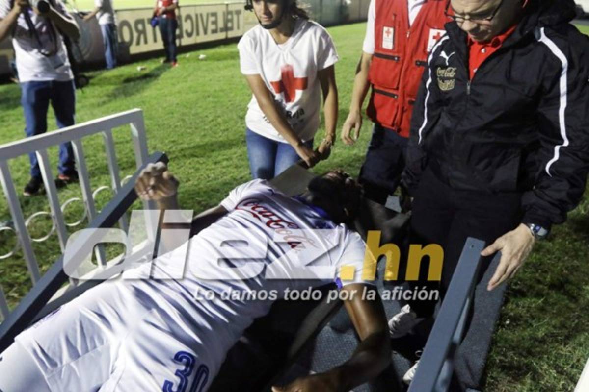 Las imágenes que la televisión no mostró de la jornada 17 en Honduras