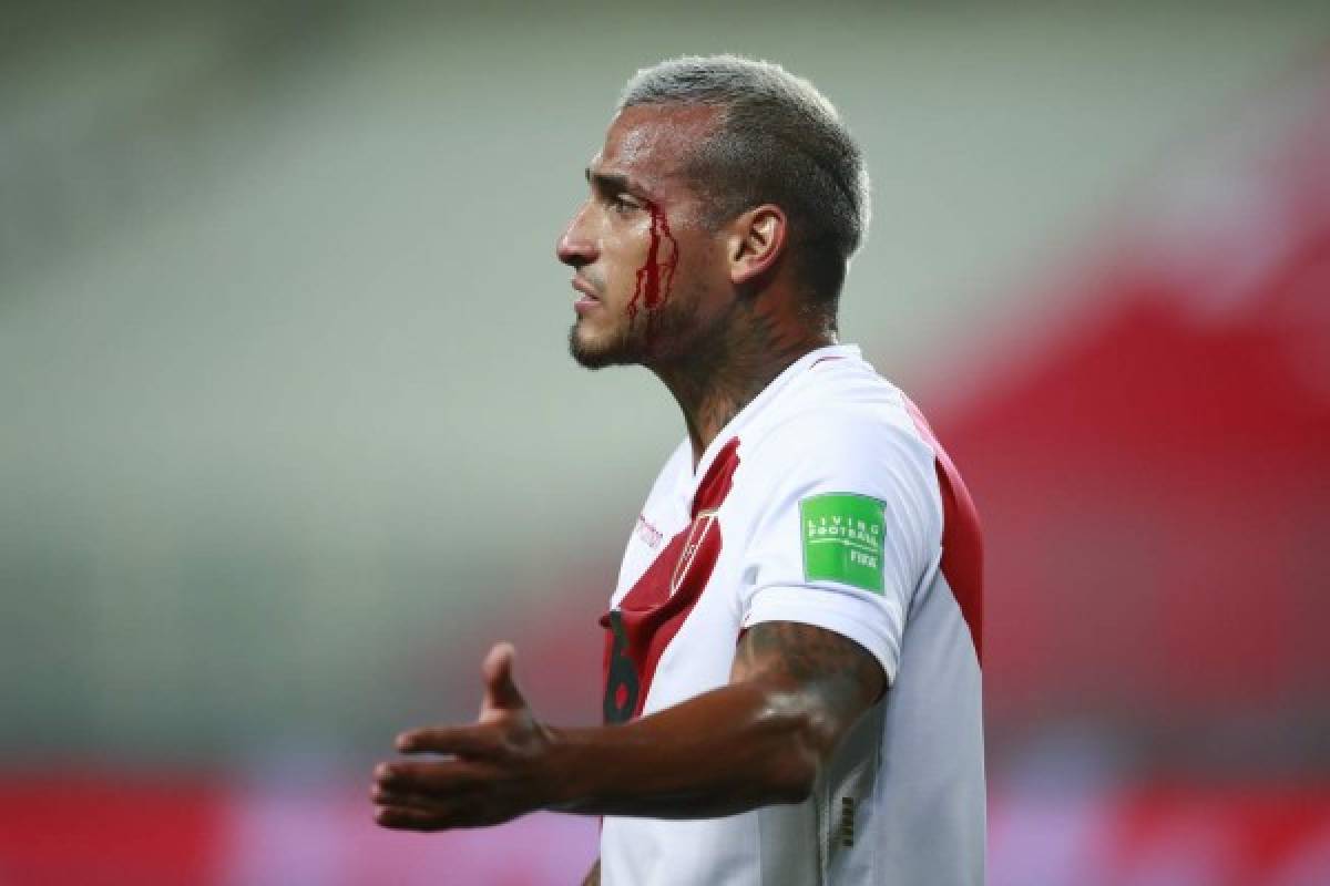 Fotos del Perú - Brasil: Las patadas a Neymar y la sangre de Miguel Trauco