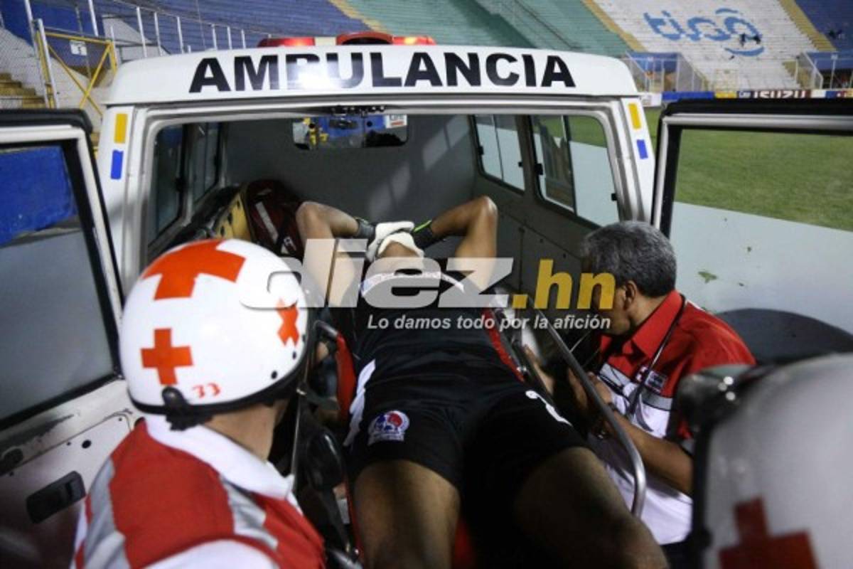 ¡QUÉ DRAMÁTICO! La espeluznante lesión de Donis Escober