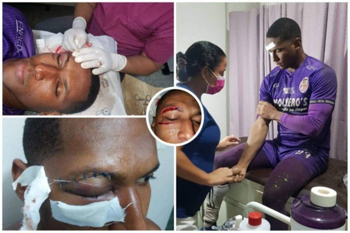 Lo que no viste en TV en la jornada 9: bellezas, beso apasionado de Pereira ¡y graves heridas a dos jugadores!