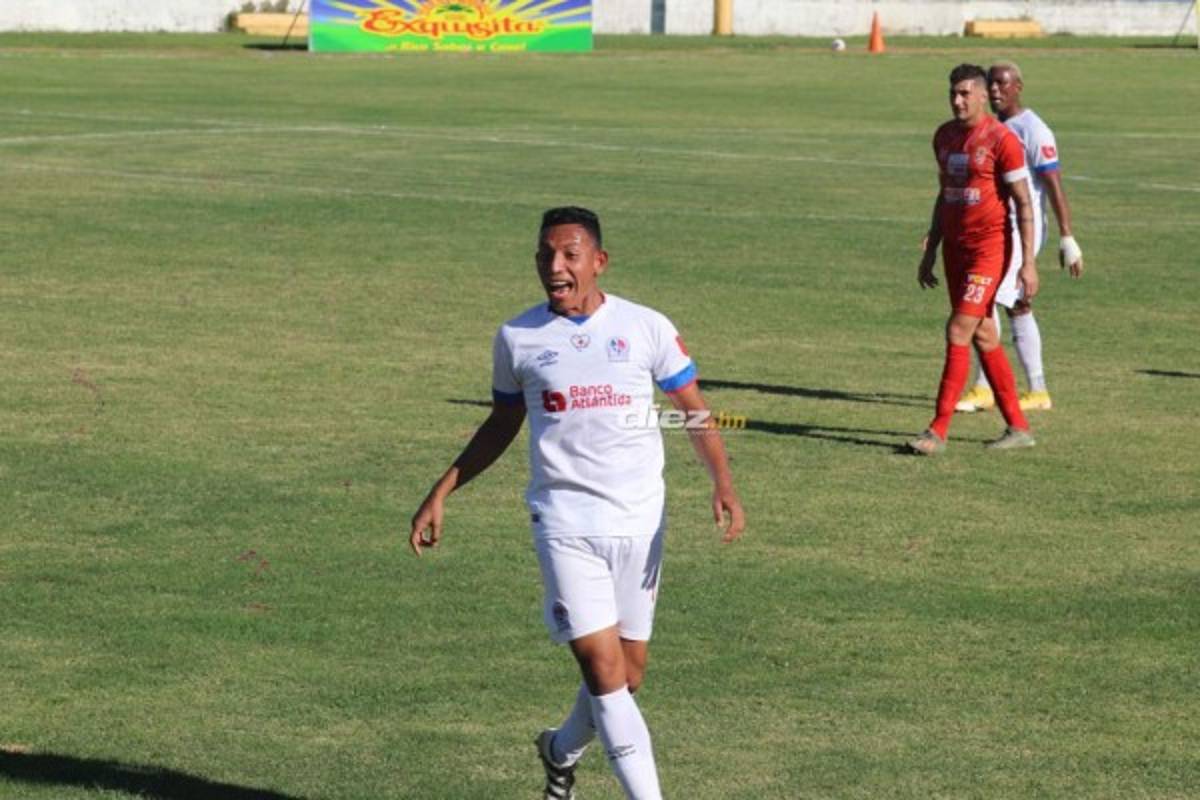 Con bajas sensibles: El 11 confirmado de Olimpia para enfrentar a UPNFM en la jornada ocho del Clausura 2021