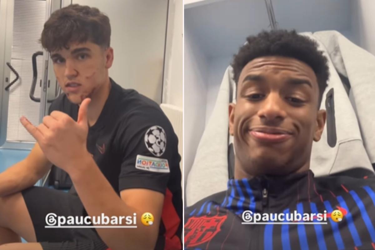 “Me salpicó su sangre, el corte es impactante”: así quedó la cara de Cubarsí tras sufrir una patada en la Champions