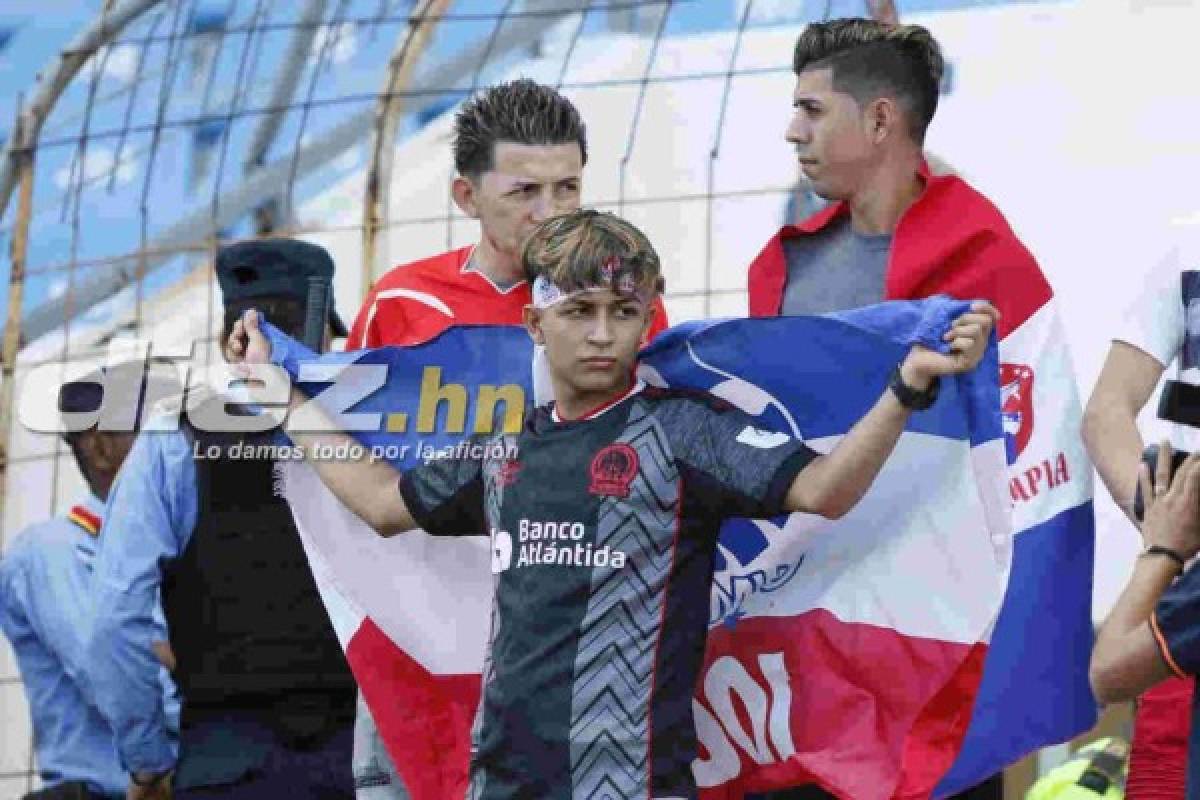 ¡Invasión olimpista! Así se vive la previa del clásico capitalino en el Olímpico