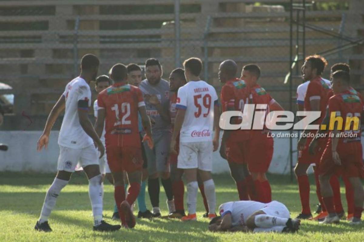 Fotos: La bronca de Obed con Carlos Pineda y el portero del Real de Minas que jugó de delantero