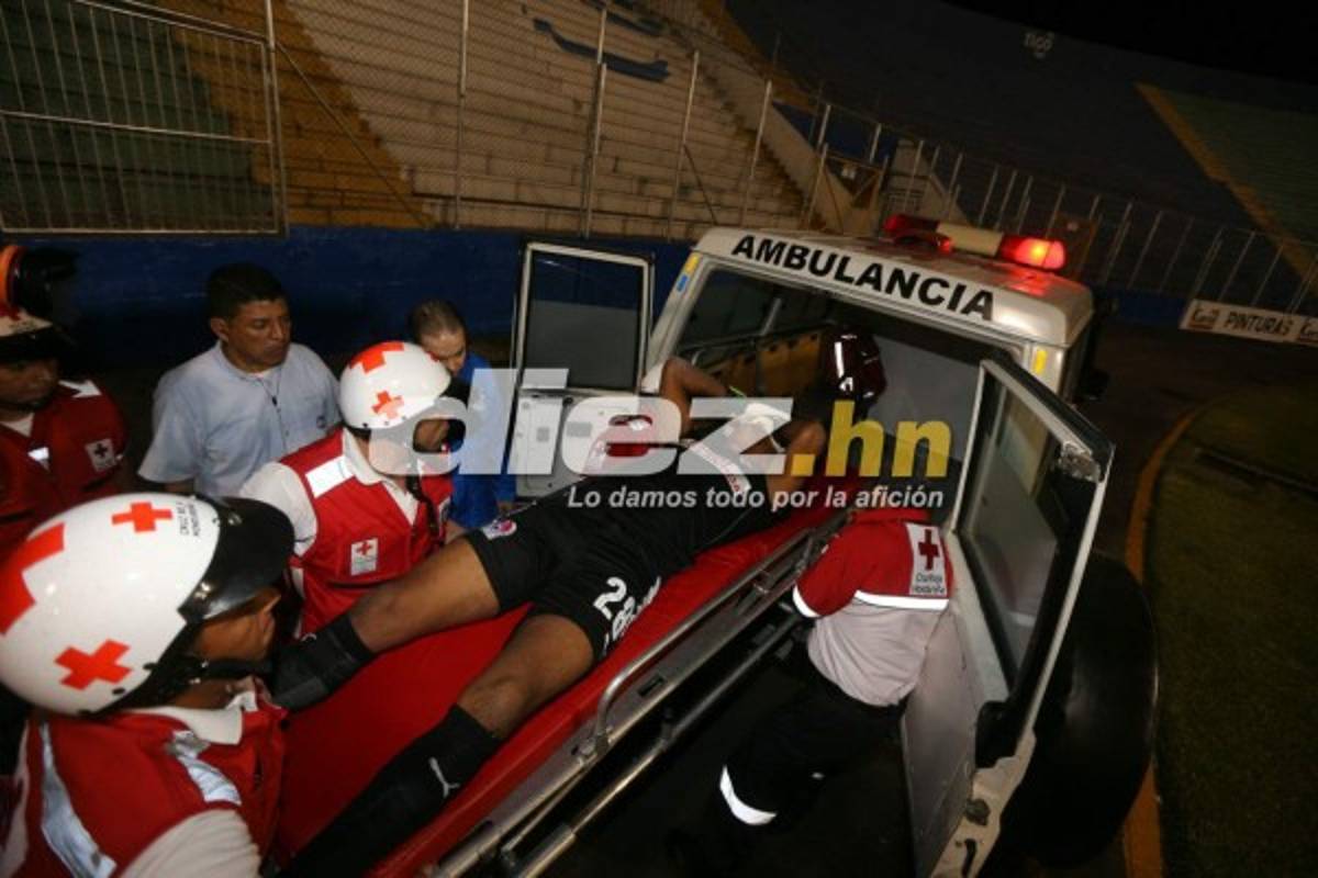 ¡QUÉ DRAMÁTICO! La espeluznante lesión de Donis Escober