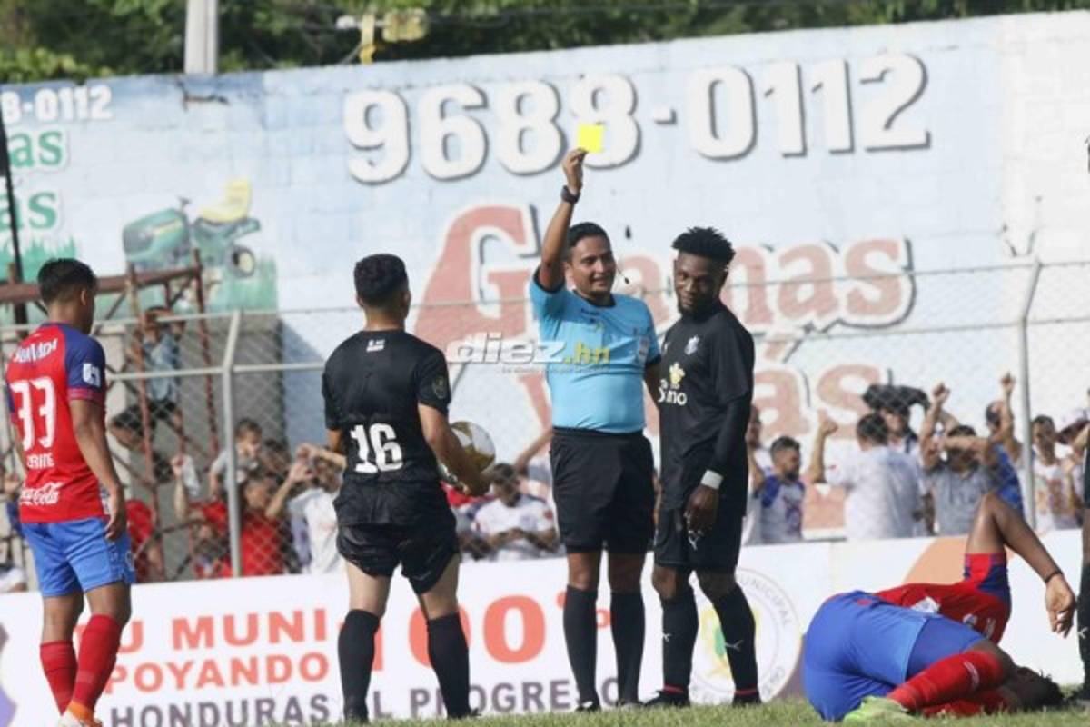 NO VISTE EN TV: El penal a Michaell Chirinos, actos protocolarios y vómito de Ferrari