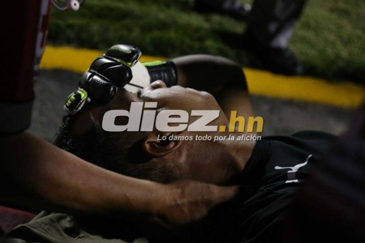 ¡QUÉ DRAMÁTICO! La espeluznante lesión de Donis Escober