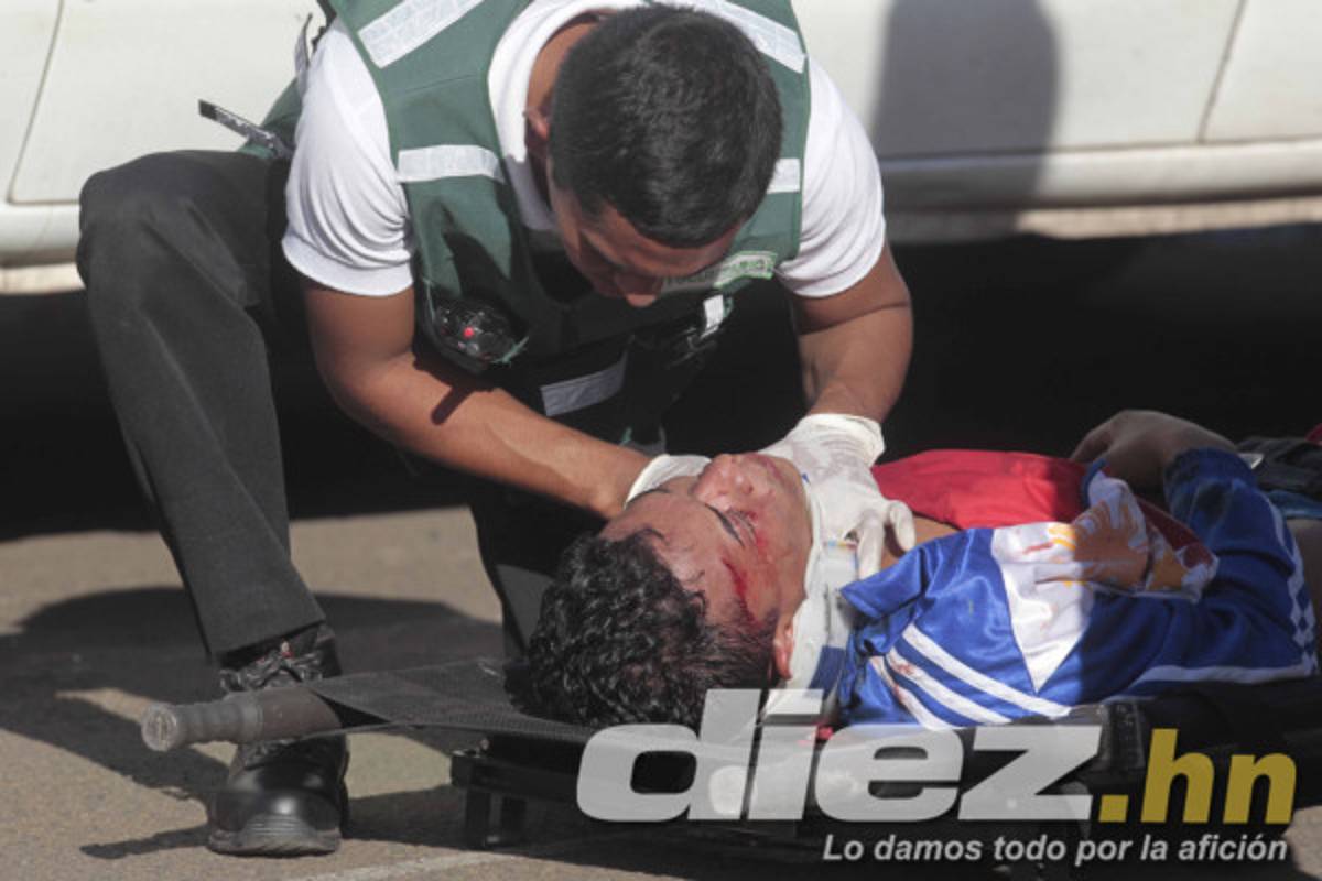 Violencia en las gradas empaña clásico capitalino