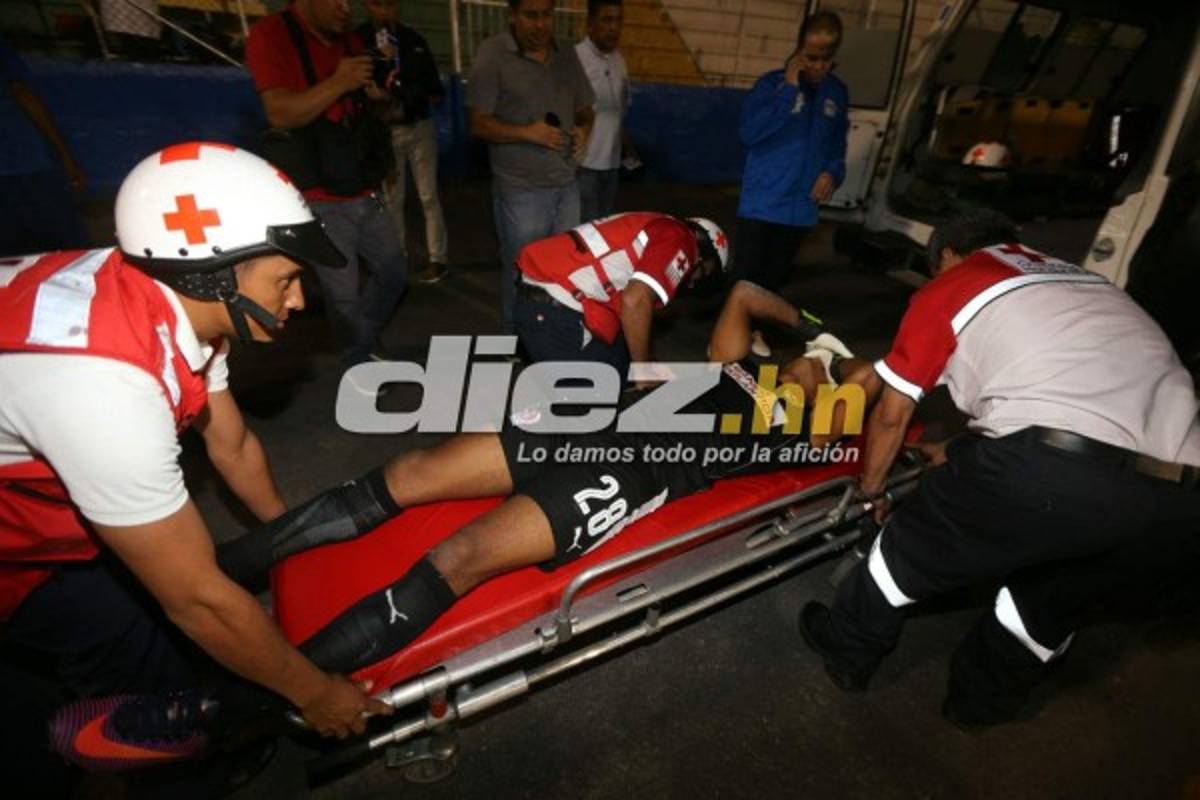 ¡QUÉ DRAMÁTICO! La espeluznante lesión de Donis Escober