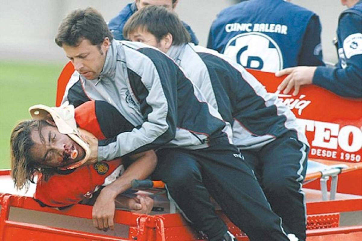 ¡No apto para sensibles! Las lesiones más escalofriantes que se han visto en el fútbol