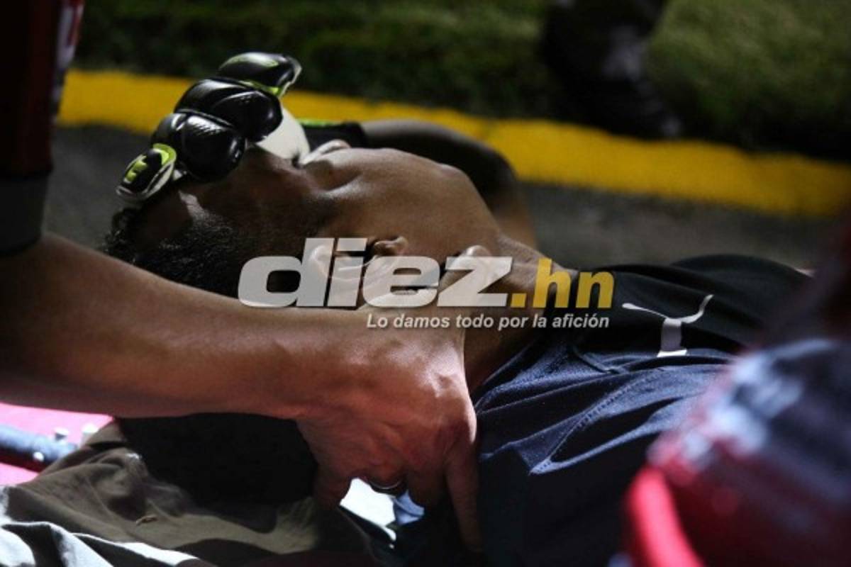 ¡QUÉ DRAMÁTICO! La espeluznante lesión de Donis Escober