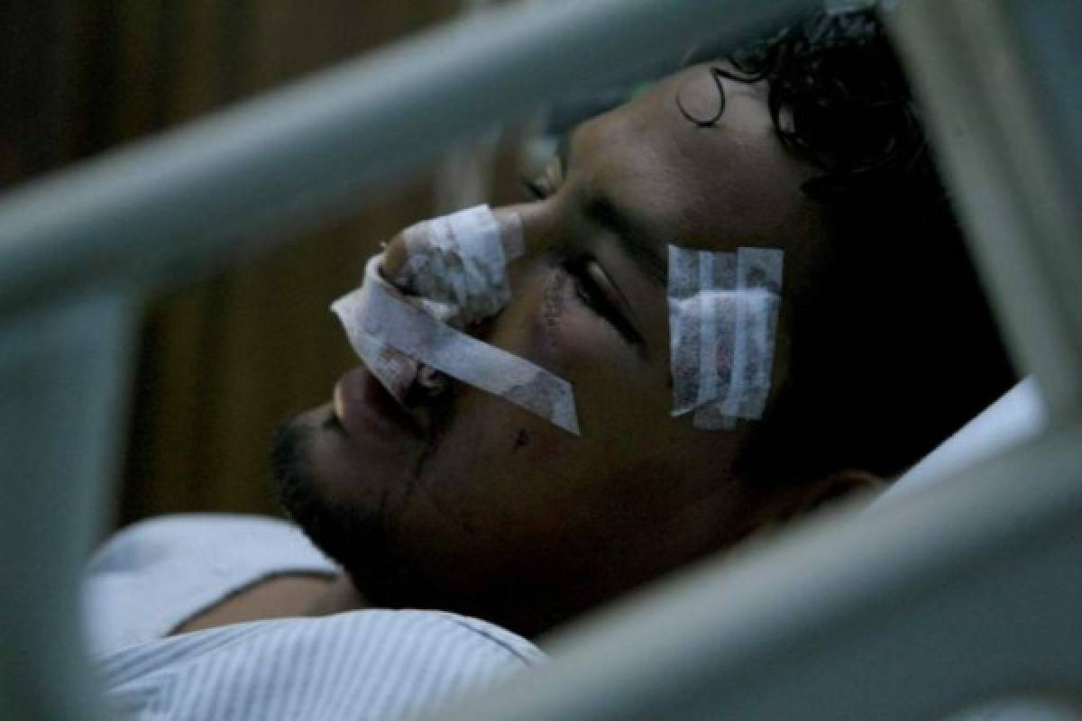FOTOS: Las lesiones y golpes más dramáticas del fútbol hondureño