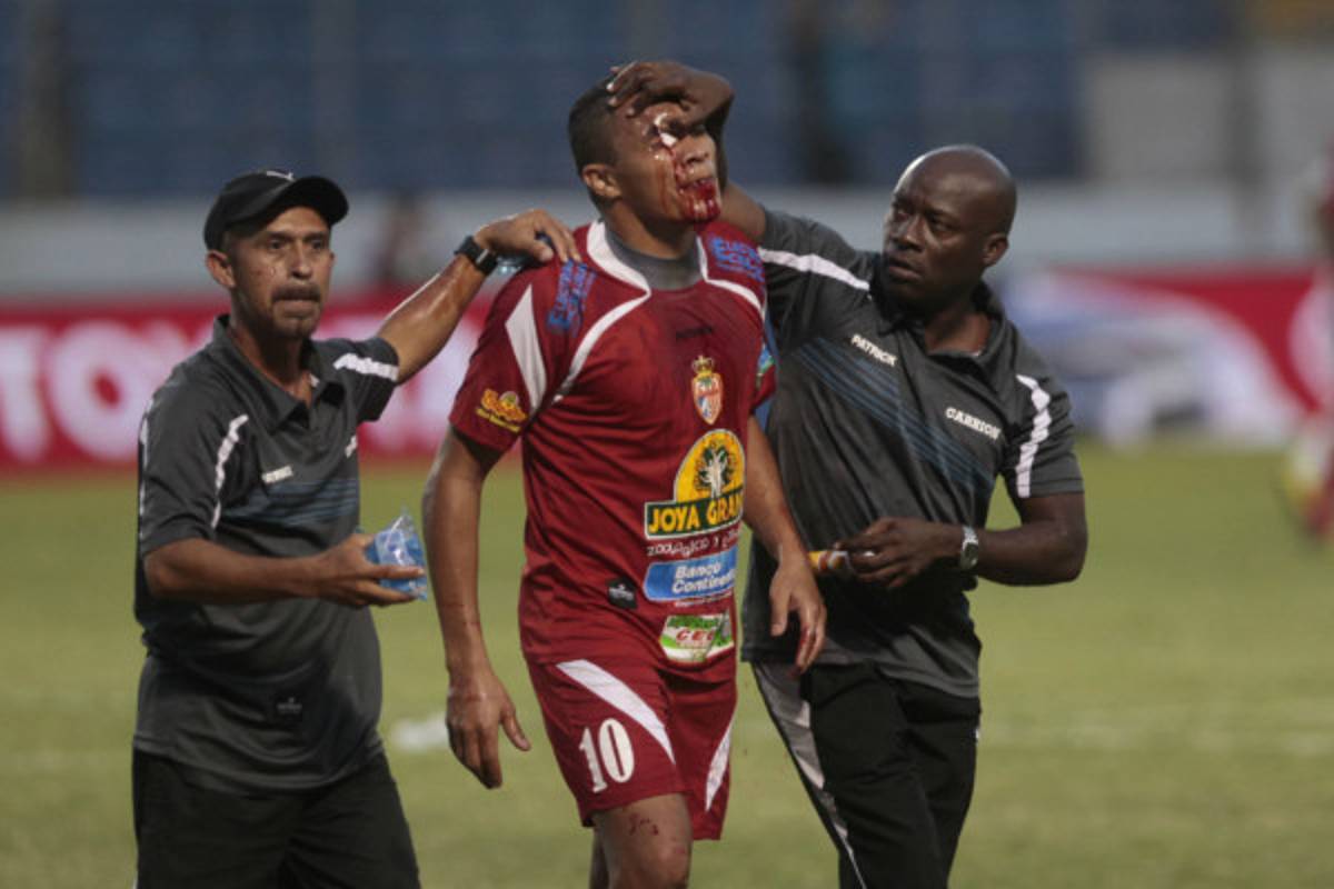 El controversial regreso de Rambo a Tegucigalpa