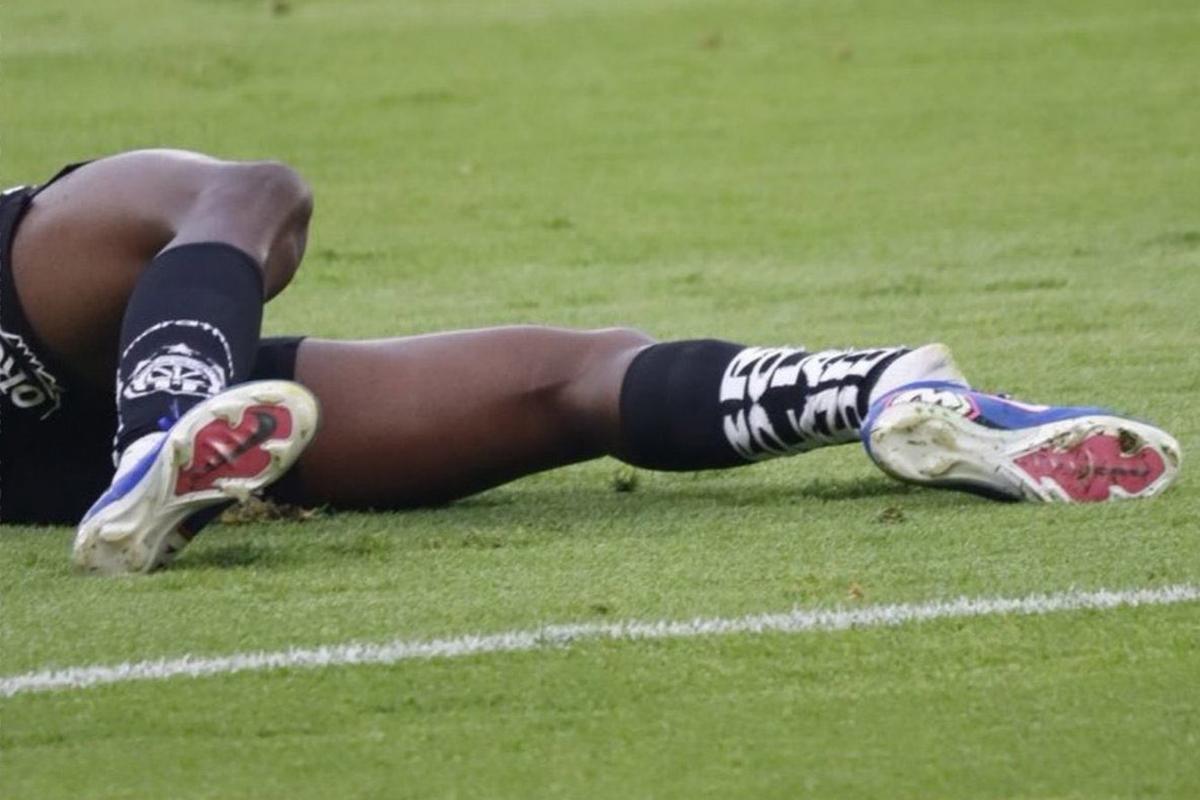 Así quedó la pierna izquierda de Arroyo por la durísima entrada que recibió de Brian Negro.