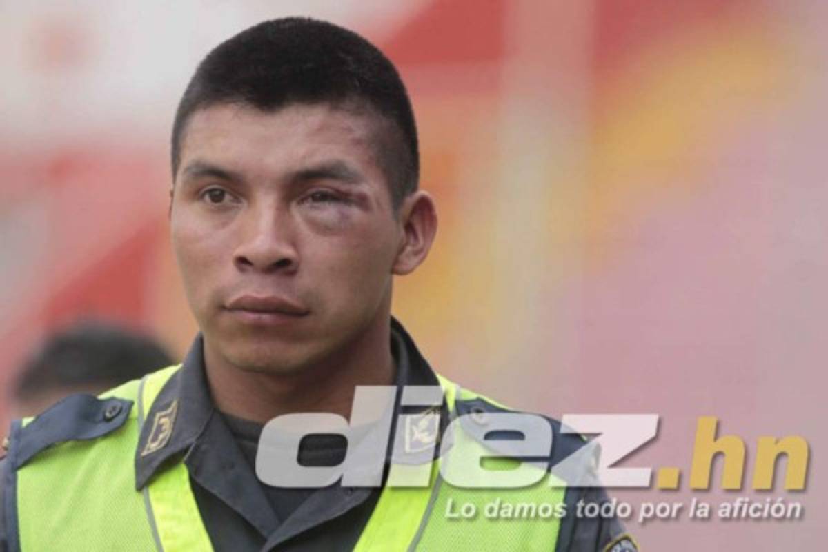 ¡Repudiable! Los actos más bochornosos en la historia Liga Nacional