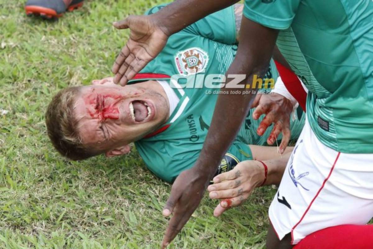 NO VISTE EN TV: El amor de un juvenil al escudo del Platense, persignación y la herida de Techera