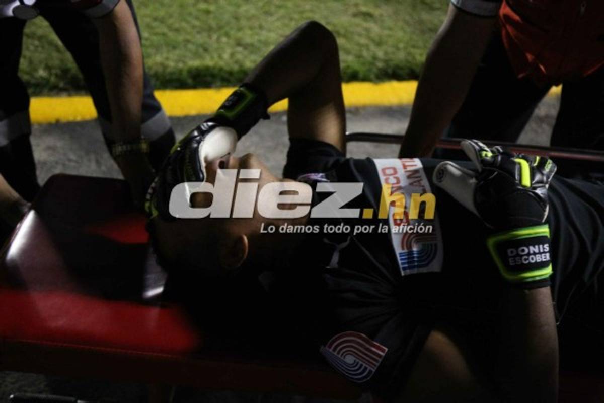 ¡QUÉ DRAMÁTICO! La espeluznante lesión de Donis Escober