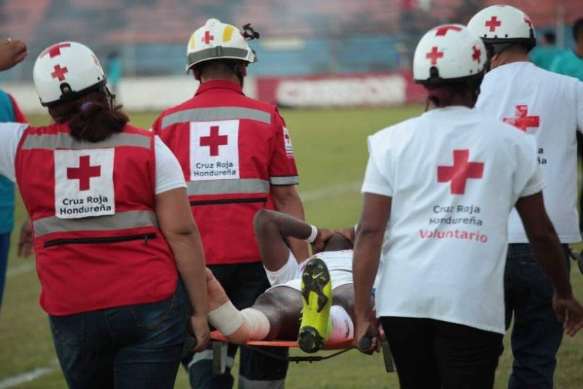 ¡Fracturas! Las graves lesiones que se han dado en el fútbol hondureño