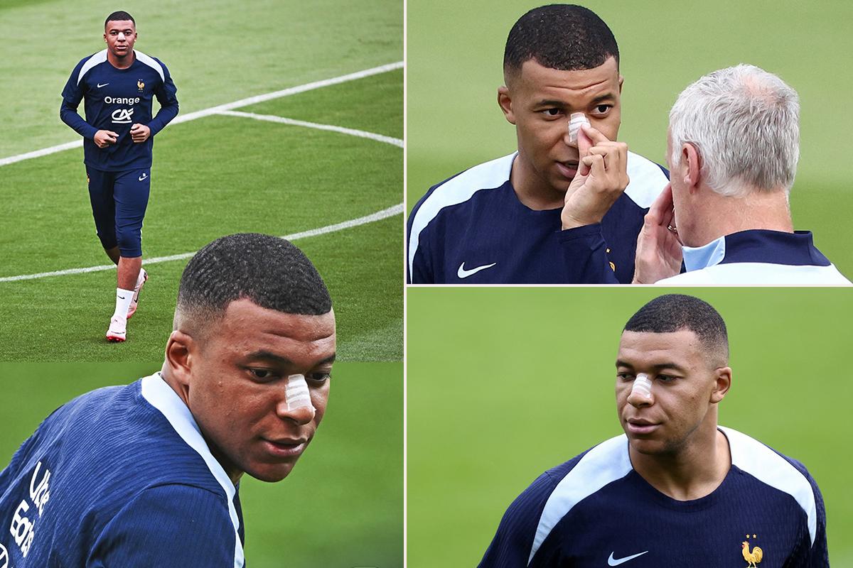 Las primeras fotos de Kylian Mbappé tras fracturarse la nariz en la Eurocopa 2024: el anuncio de su entrenador