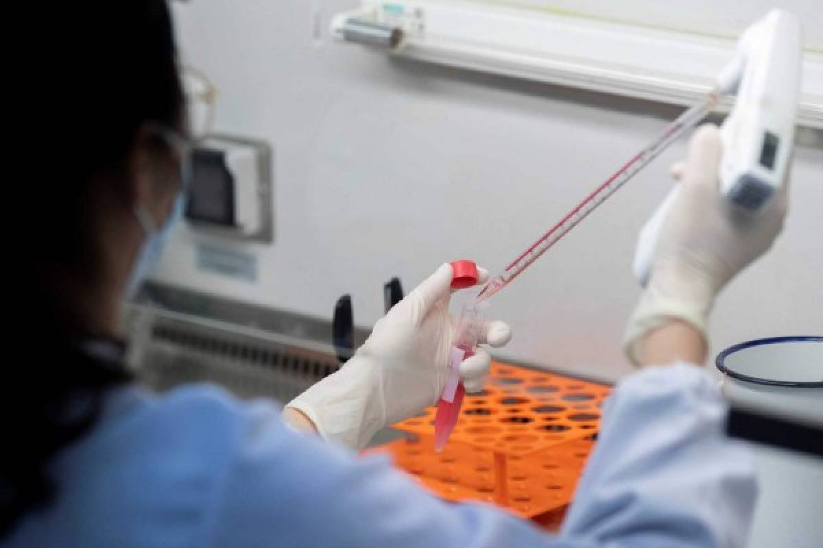 Coronavac: La vacuna que trabajan en China para combatir la pandemia del coronavirus