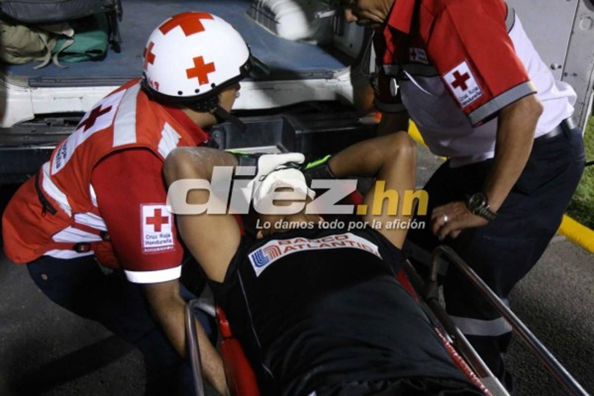 ¡QUÉ DRAMÁTICO! La espeluznante lesión de Donis Escober