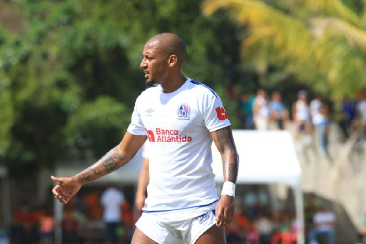 EQUIPAZO: Así es el otro once alternativo que tiene el Olimpia