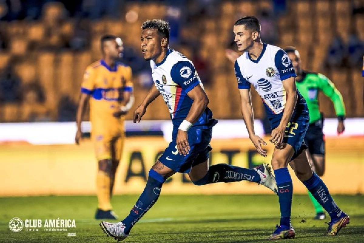 ''Juego de Barbies'': figura de Tigres explota y así quedó la pierna de jugador del América en la Liga MX