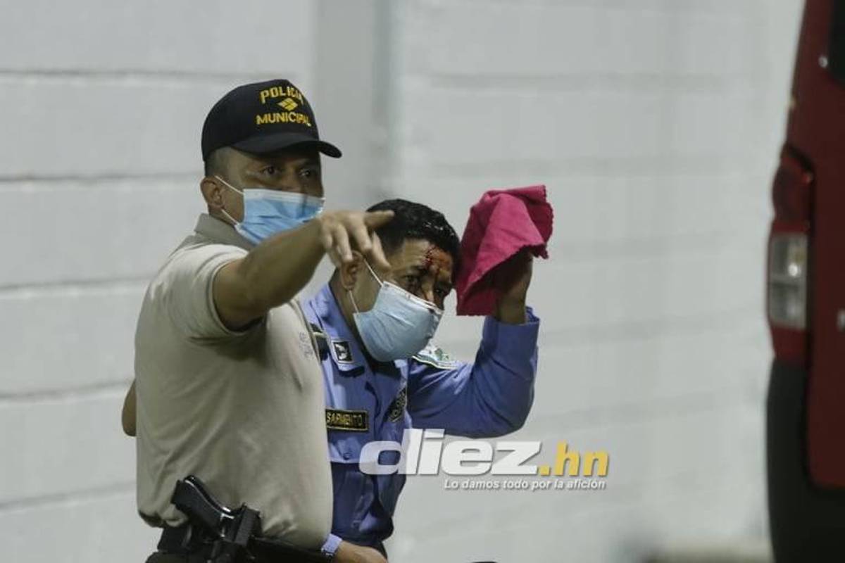 Joven cayó de espaldas al suelo: las otras fotos que no viste del zafarrancho del Real España-Marathón ¡varios policías heridos!