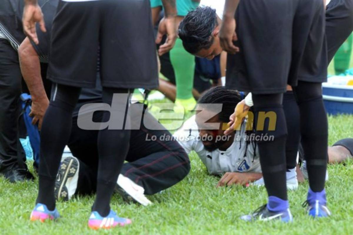 ¡Sangre, lágrimas y despedida! Las imágenes de la Jornada que no viste en TV
