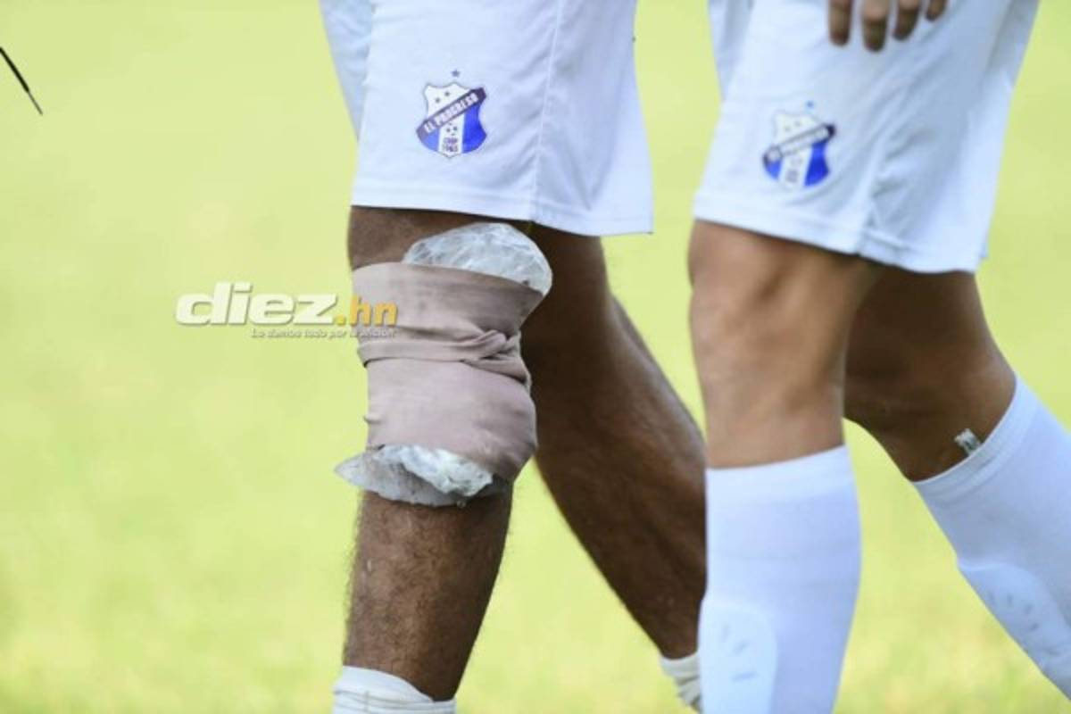 No viste en TV: Apasionado beso, sufrimiento de Elías Nazar y barra del Real España