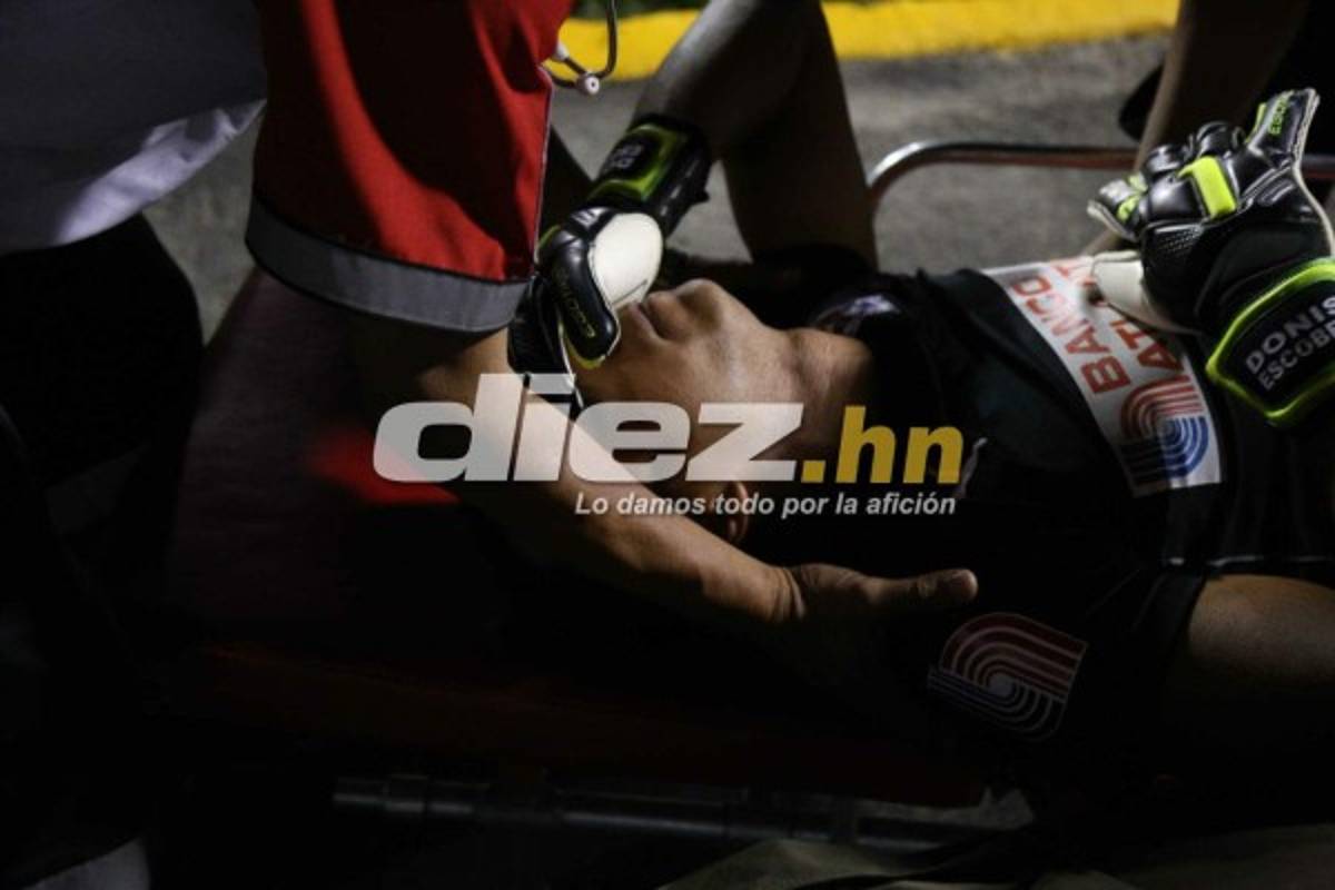 ¡QUÉ DRAMÁTICO! La espeluznante lesión de Donis Escober