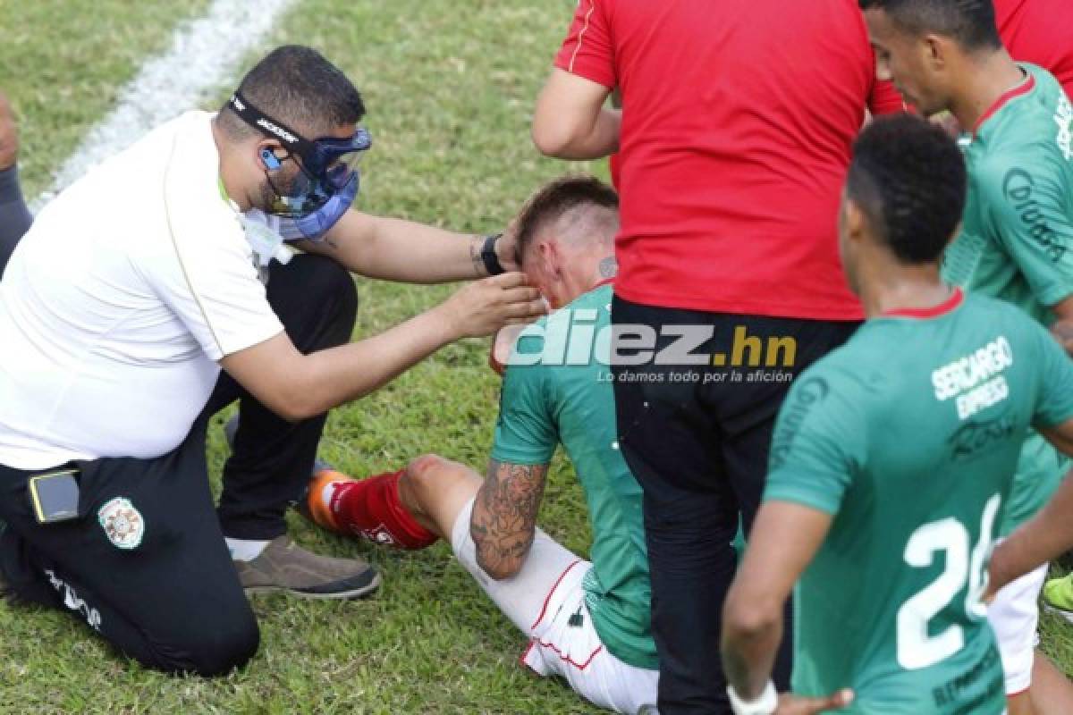 NO VISTE EN TV: El amor de un juvenil al escudo del Platense, persignación y la herida de Techera