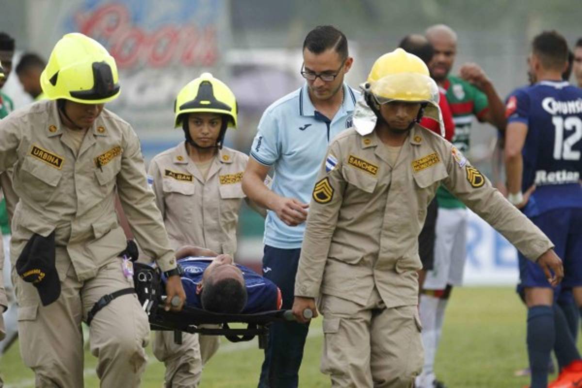 FOTOS: Así le quedó el rostro a Eddie Hernández tras el terrible golpe