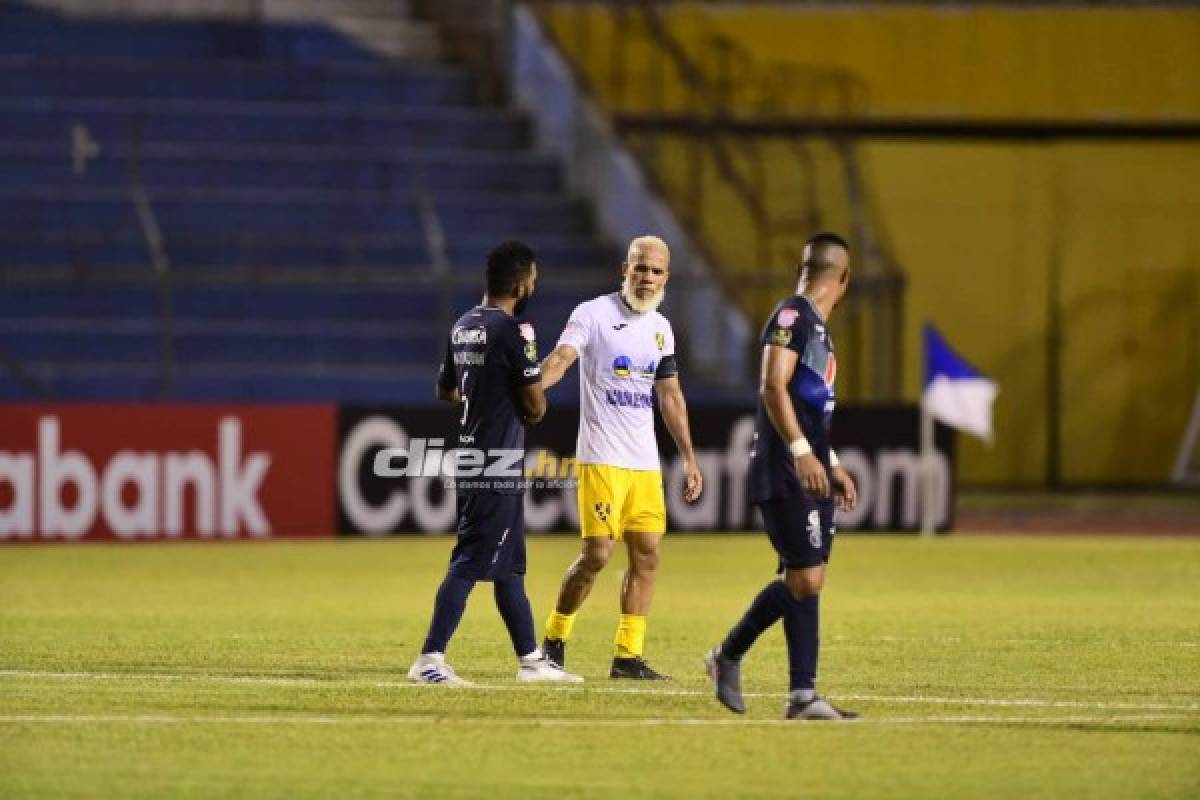 Azúcar, apagón y clasificación: Así sufrió Motagua para seguir en la Liga Concacaf