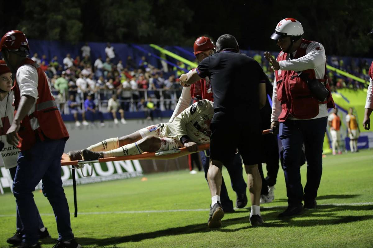 El fichaje de Olimpia, los 2 penales que reclamó el león y Bengtson sorprendió