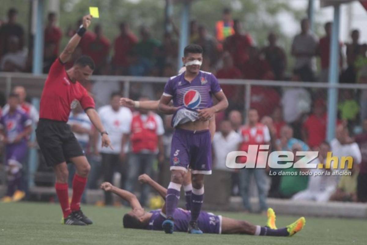 ¡Belleza, júbilo y llanto! Las imágenes curiosas de las semifinales del Ascenso
